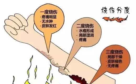 被油烫伤用什么方法最快好不留疤,电焊烫伤用什么方法最快好不留疤