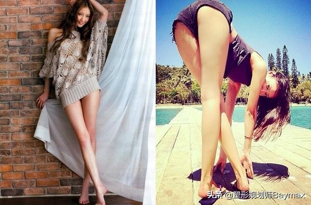 女人大腿松弛什么原因,减肥后大腿内侧松弛怎么办