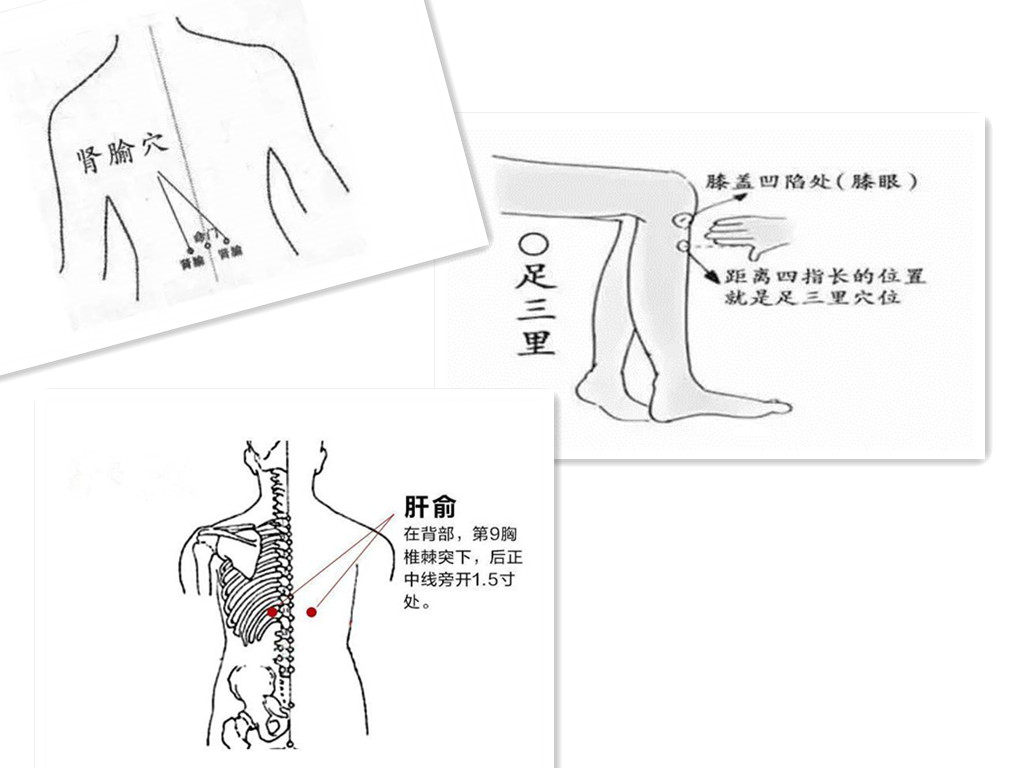 连续上班累成狗小心患上周期性瘫痪——宏世堂今日干货分享
