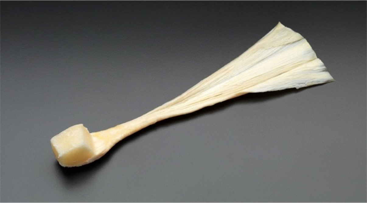 前叉重建单束可以满足运动要求么,前叉重建有几个切口