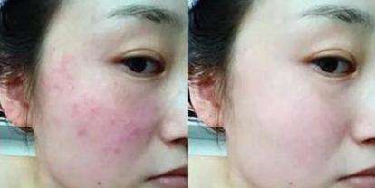 胎盘前壁后壁文案,胎盘的文案