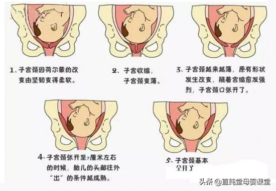 胎儿入盆是什么感觉和症状,胎儿入盆是什么感觉和症状呢