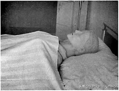 护理老人头发梳理与清洁,头部清理护理套餐