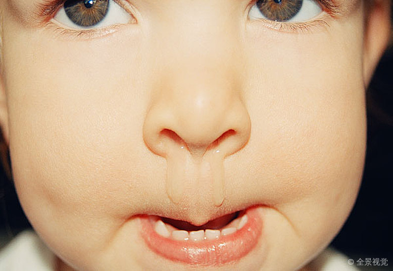 儿童鼻塞美国人怎么通鼻子,缓解儿童鼻塞吸鼻涕的妙招