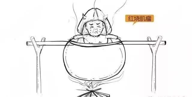 漫画详解子宫肌瘤是个啥?