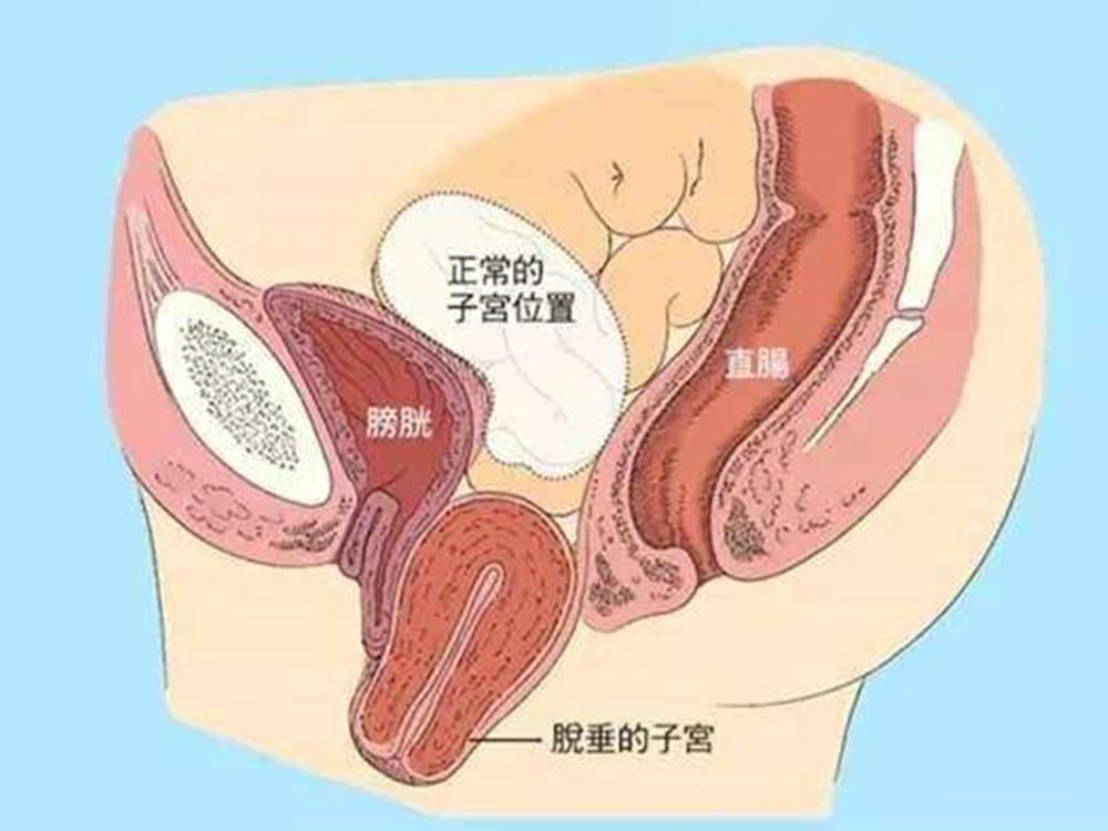 顺产后突然出现剧烈腹痛,宝妈生完孩子后腹部剧痛