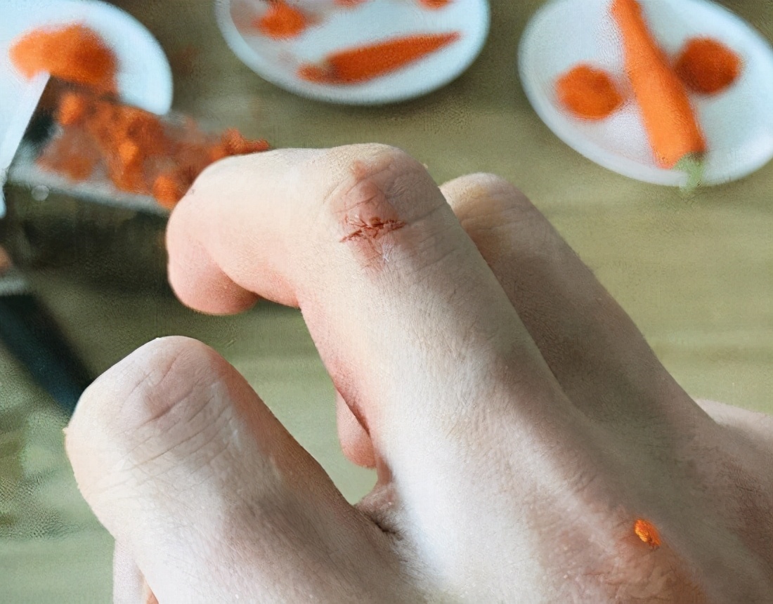 脸部受伤需要打破伤风针吗,狗自己受伤用打破伤风针吗