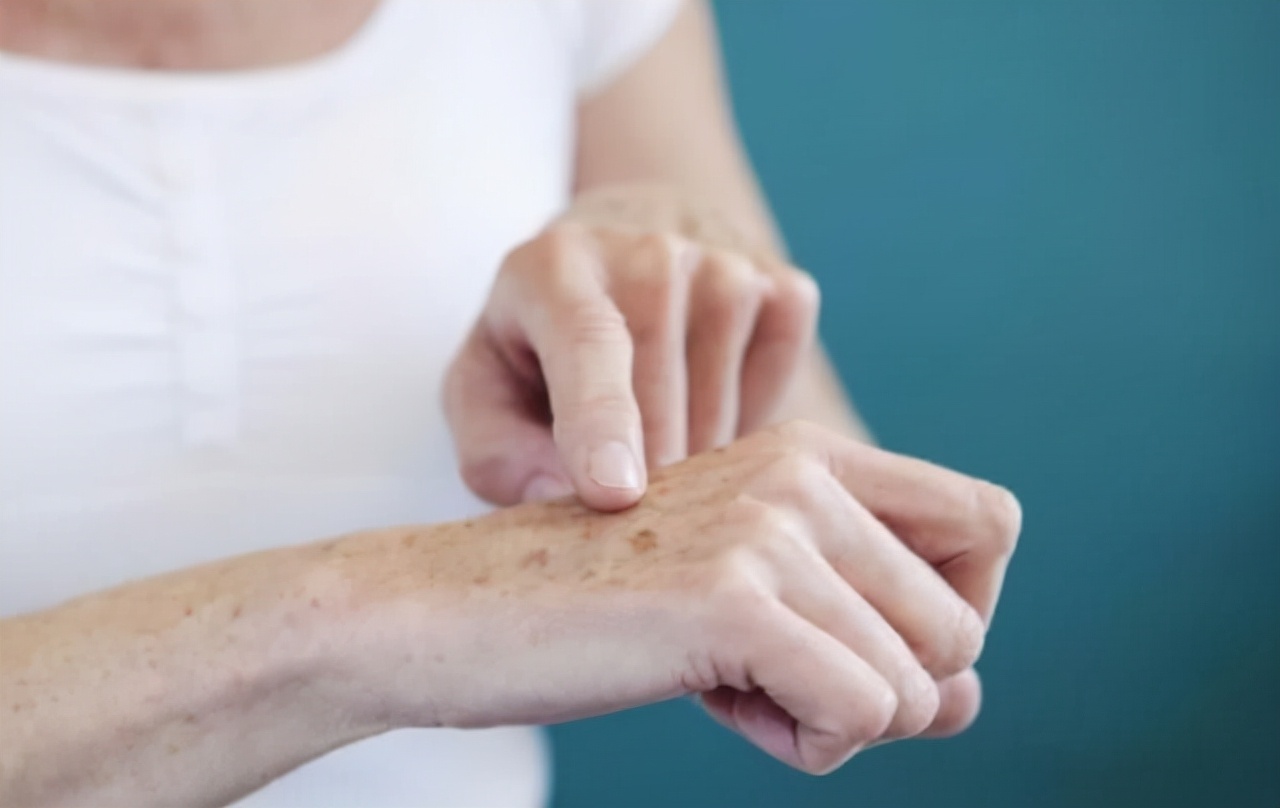 老年斑一刮就干净,年轻人起了老年斑是什么原因