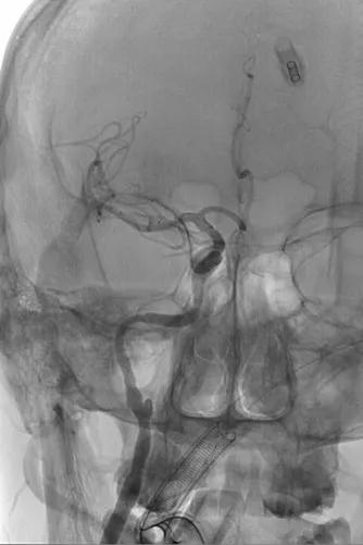 山西省人民医院任少华教授,山西省人民医院任少华