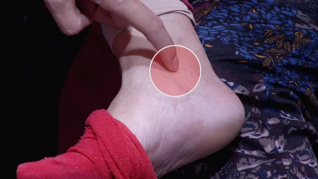 失眠多梦按摩哪些穴位最有效,1个穴位专治失眠视频