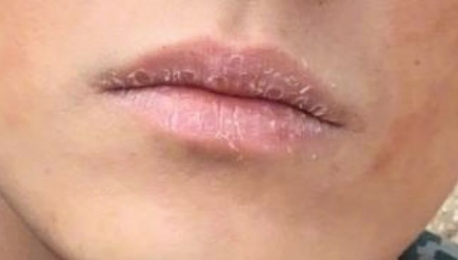 李易峰嘴唇上薄下厚,李易峰唇膏