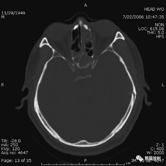 值夜班需要注意什么身体健康,值夜班的十大危害