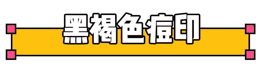 如何祛痘印?看了这篇能解决你大部分的问题!
