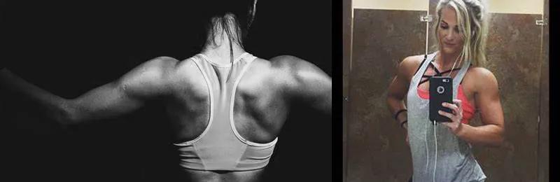 公认有效的肩部动作,畸形肩部审美