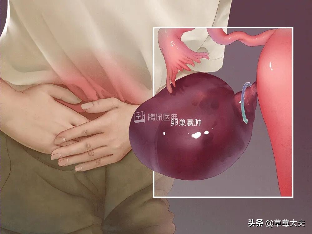 女孩腹痛难忍到医院,女童腹痛剧烈