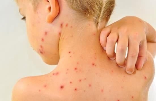 波轮洗衣机内部怎么清洗,lg波轮洗衣机怎么拆开清洗污垢