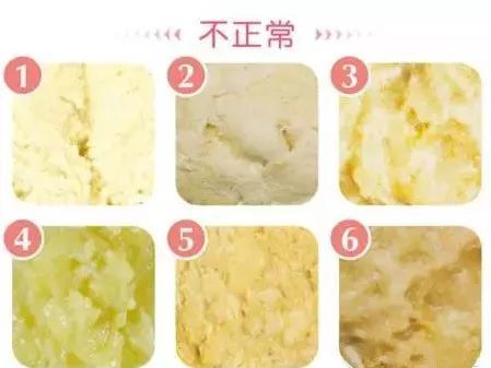 宝宝身体状况可以通过便便知道吗,宝宝的便便早知道