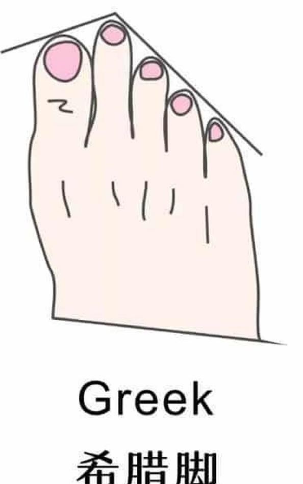 女性脚型有哪几种,女性脚型有哪些