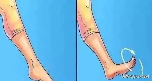 脚踝扭伤一个月后康复训练法,脚踝扭伤是否需要康复训练