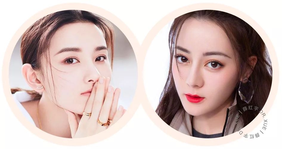 那些要求双眼皮术后效果立竿见影的姑娘们，后来怎么样了？