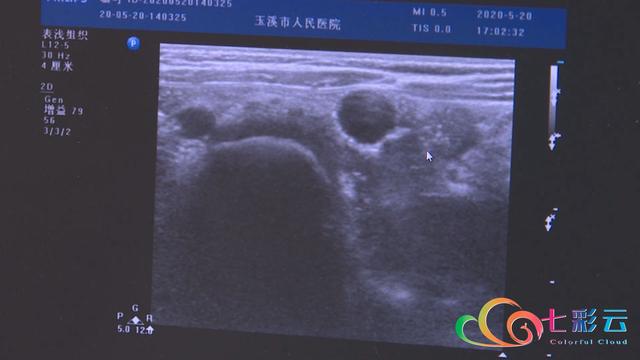 宝宝误食海洋宝宝后的反应,如何判断是否误食海洋宝宝