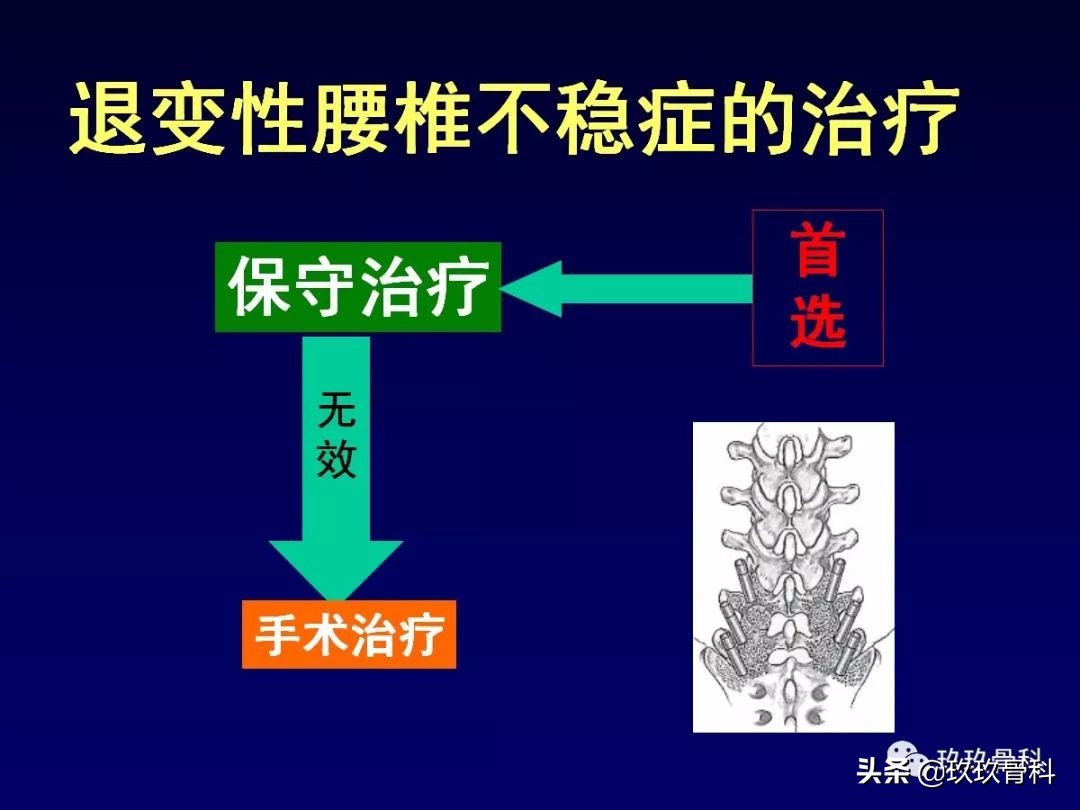 腰椎不稳最坏的结果,腰椎不稳的最佳治疗方法