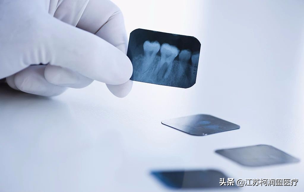 种植牙需要注意避开哪些坑,种植牙怎么选择适合自己的