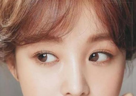 上海九院整形科孙教授,上海九院孙英双眼皮修复