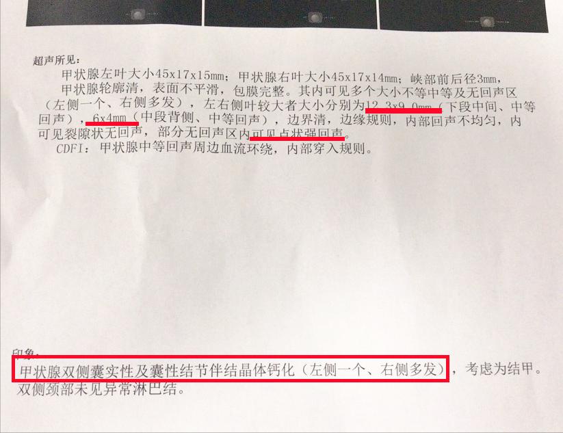 甲状腺结节一般中药调理多长时间,治甲状腺结节中药一般熬多长时间