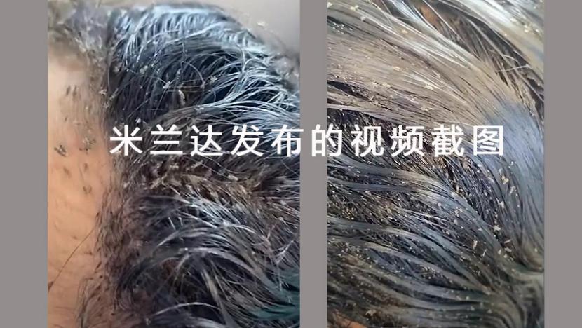 虱子有多大,虱子有几种叫法