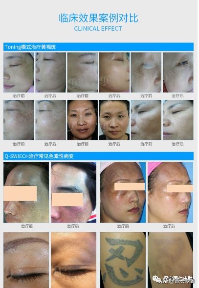 皮肤病患者科普,皮肤病患者最担心的问题