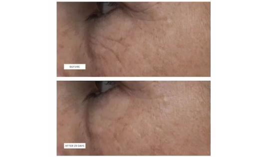 春夏护肤|消除黑眼圈才是首要任务