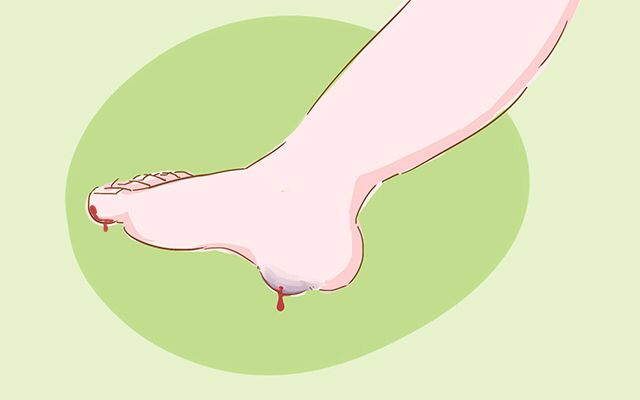 孩子鞋子磨脚属于质量问题吗,孩子穿鞋磨鞋底严重