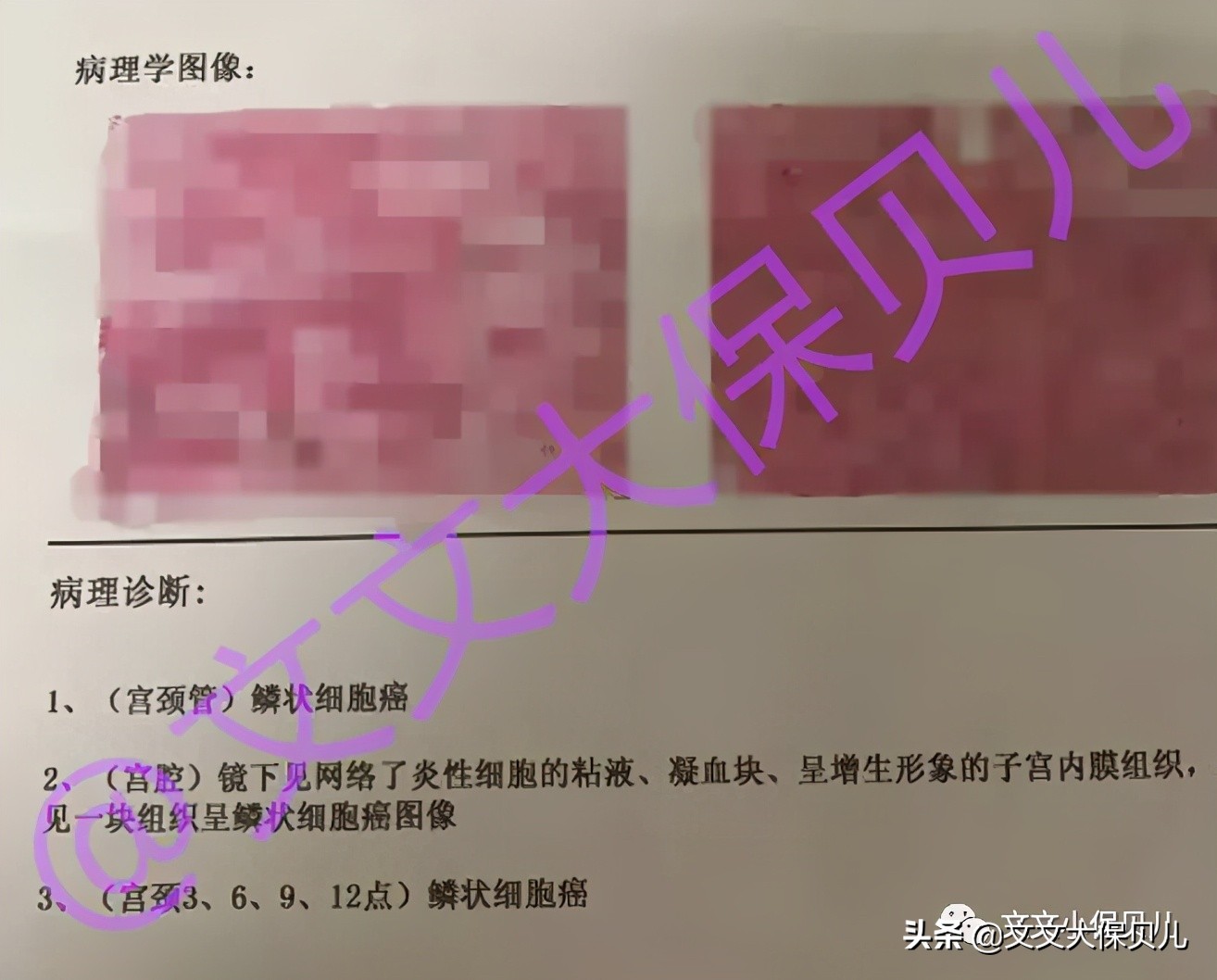 互联网保险理赔纠纷,互联网人身保险重疾险