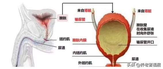 为什么说出现尿失禁很难救回来,尿失禁导致社交障碍