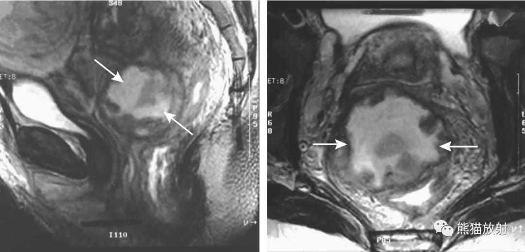 腹部影像图片大全,乙状直肠疼痛位置图片