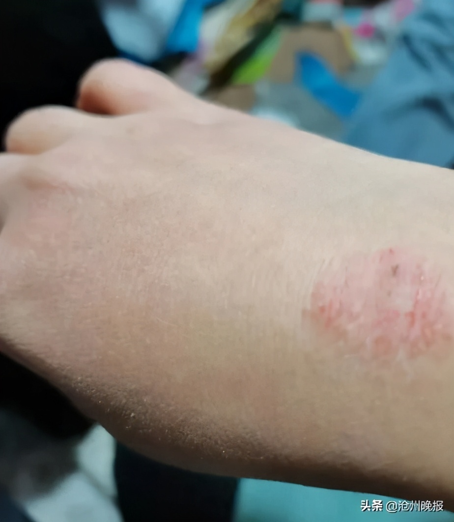 轻伤不下火线的医护人员,轻伤不下火线事迹