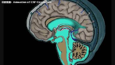 脑子里真的可以进水吗,一张图看懂脑积水