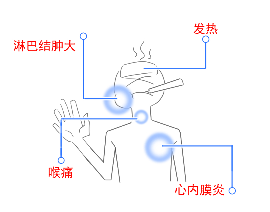 关节炎阴雨天加重是风湿引起的吗,阴雨天风湿病会加重吗