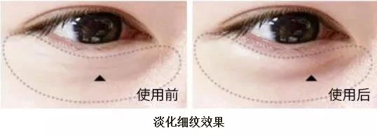 肖战敷面膜现身,肖战眼膜