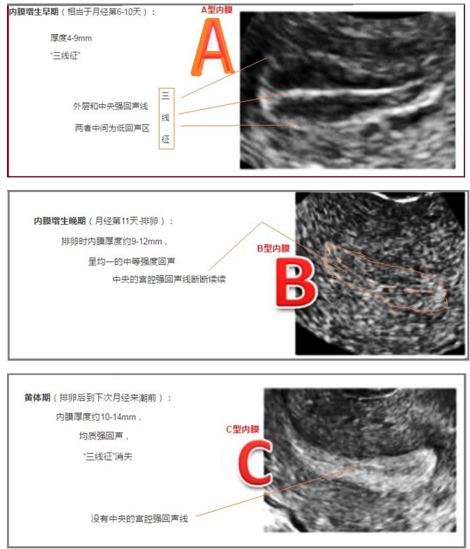哪些原因会导致子宫内膜增厚,什么引起子宫内膜增厚
