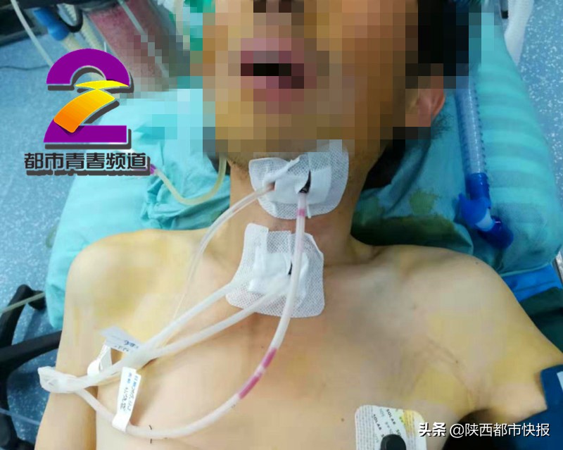 男子牙疼出脓液,男子因牙疼致感染