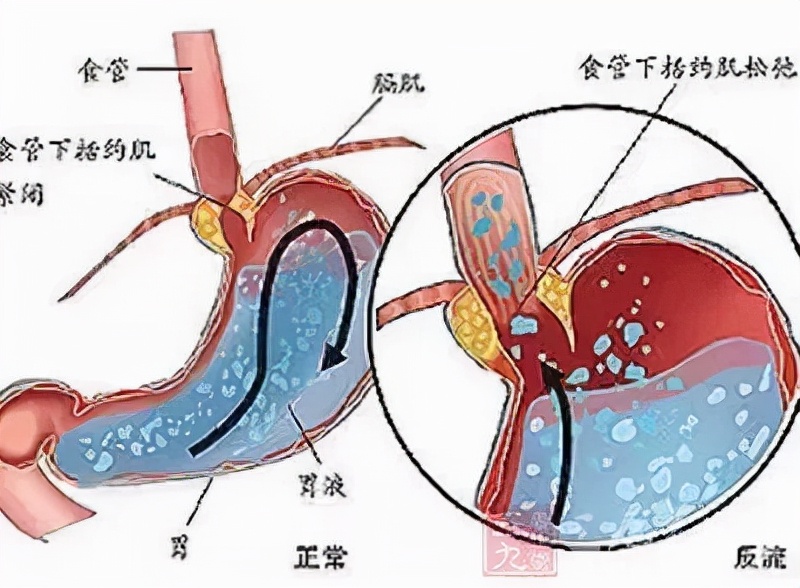 宝宝吐奶厉害有什么偏方,宝宝吐奶什么方法都试过了
