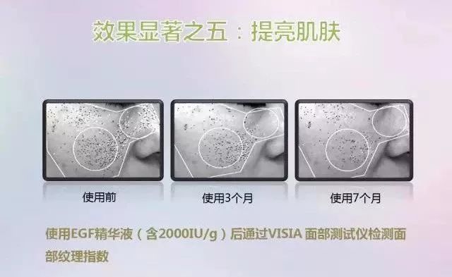 干粉冷冻,冷冻干粉的作用和功效