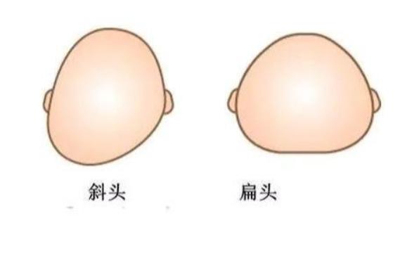 小孩后脑勺很平有什么影响吗,小孩后脑勺尖是否聪明
