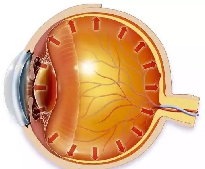 玻璃体和视网膜脱离,眼睛视网膜完全脱离
