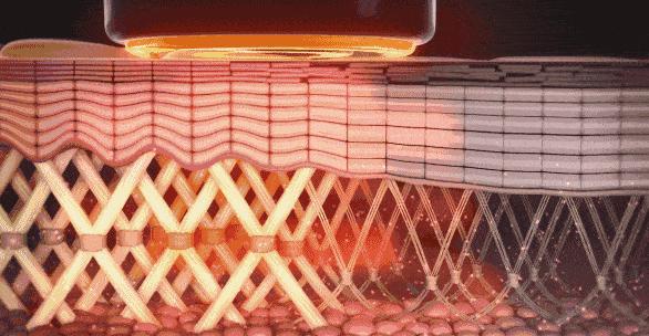 热拉提2.0好还是热玛吉好,热拉提跟热玛吉哪个性价比高