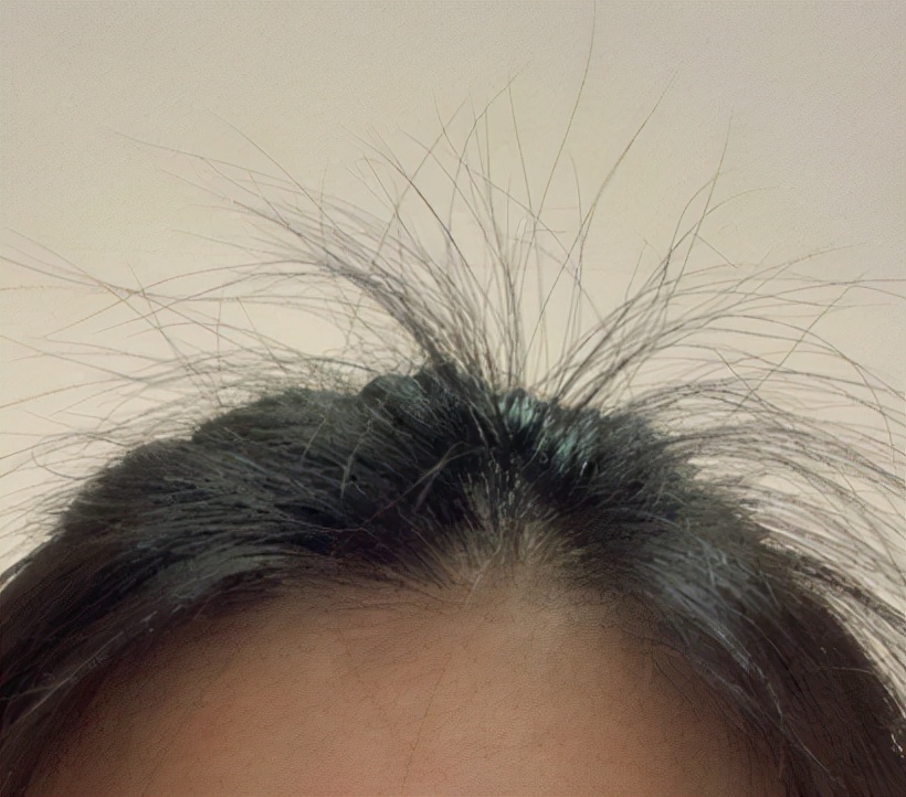 什么汤让头发蓬松,怎么让头发蓬松起来