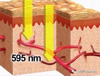 瘢痕疙瘩都有哪些治疗方法呢？