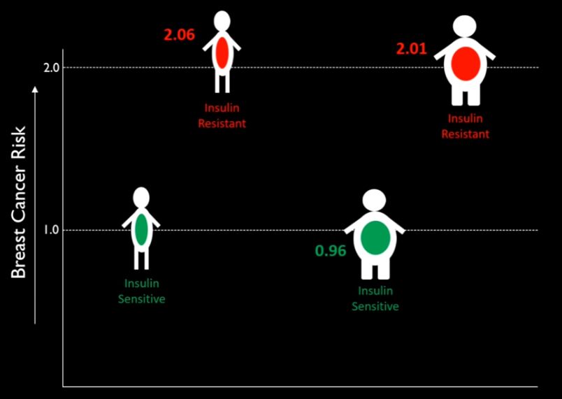 乳腺癌15种锻炼方法,断食或能阻挡乳腺癌发展